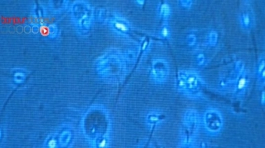 Entre 1973 et 2011, la concentration en spermatozoïdes est passée en moyenne de 99 millions par millilitre de sperme à 47 millions dans les pays occidentaux.