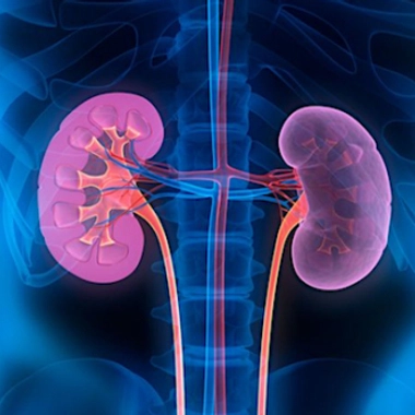 La pyélonéphrite : une infection grave du rein