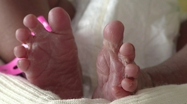 Prématurés : les enfants nés avant terme sont en meilleure santé qu'il y a 20 ans