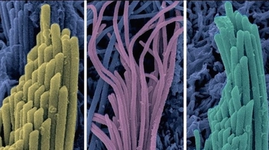 Crédits : Institut Pasteur