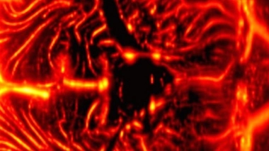 Coupe coronale du réseau vasculaire cérébral, obtenue de façon non-invasive par imagerie Doppler ultrasonore ultrarapide chez un nouveau-né prématuré. (crédit : Inserm U979/Institut Langevin)