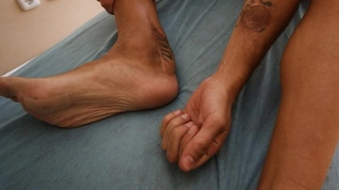 La peau de son bras tatoué a été greffée sur son talon.