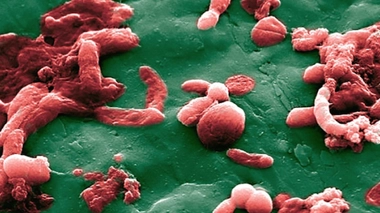 Les travaux des chercheurs de l'Institut Gustave-Roussy confirment toute l'importance de la flore intestinale dans les traitements contre le cancer.