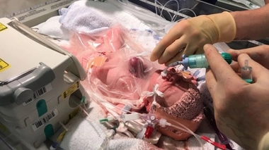 Les sept opérations les plus impressionnantes de 2017