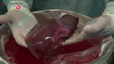 Un foie destiné à une transplantation (image d'illustration).