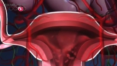 Endométriose : informer les médecins pour un meilleur diagnostic