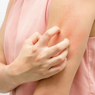 Prurit, démangeaisons : au secours, j'ai la peau qui gratte !