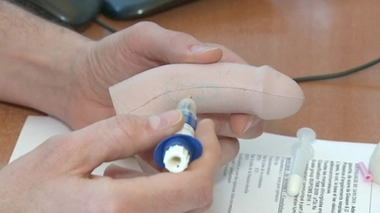 Maladies de la prostate : quel impact sur la sexualité ?