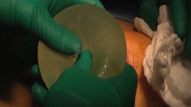 Les montant versés pourraient atteindre 6 000 à 13 000 euros par plaignante.