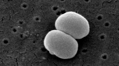 Le staphylocoque epidermidis en microscopie électronique