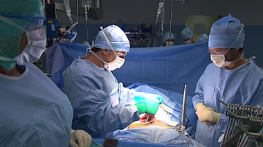 Cancer du péritoine : quels traitements existe-t-il ?