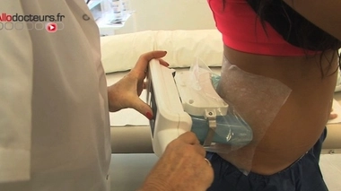 Les risques de la cryolipolyse à visée esthétique confirmés par la HAS