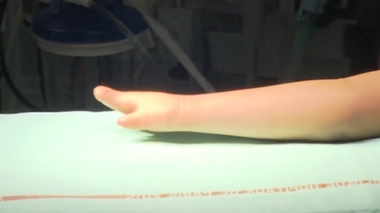 Nouvelle enquête sur les bébés nés avec une malformation des bras : une décision "encourageante" pour les familles