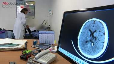 AVC : attention aux accidents ischémiques transitoires