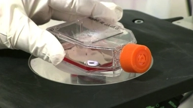 Ondes électromagnétiques de faible intensité : pourquoi elles peuvent soigner