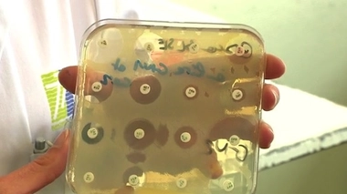 La résistance s'organise... contre l'antibiorésistance