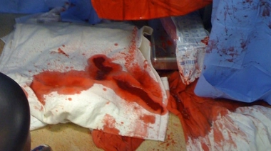 Les médecins postent des photos de leur bloc opératoire