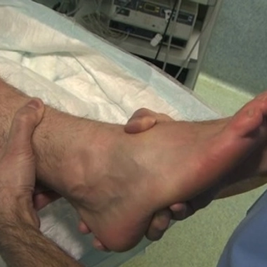 Cheville : quand faut-il opérer ?