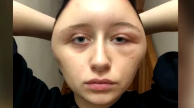 Elle frôle la mort à cause d’une teinture pour cheveux