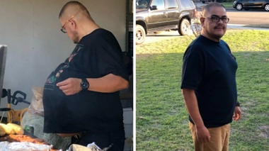 Sa tumeur pesait 35 kilos