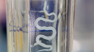 Se débarrasser des vers intestinaux