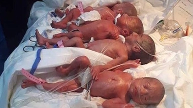 Contre toute attente, elle accouche de septuplés !