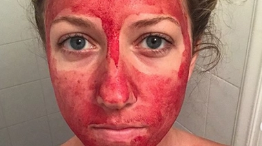S'enduire le visage de sang menstruel pour briser le tabou des règles