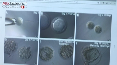 Cancer : un nouvel espoir pour préserver la fertilité des garçons