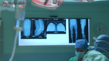 Que faire pour réduire le nombre de transfusions ?