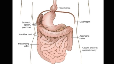 Une femme a vécu près de 100 ans avec ses organes inversés !