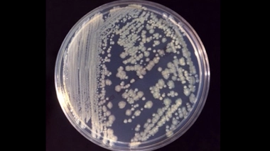 En cause : des bactéries Enterobacter cloacae dans les poches de nutrition 