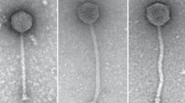Les trois phages utilisés contre l'infection bactérienne d'Isabelle Carnell-Holdaway.