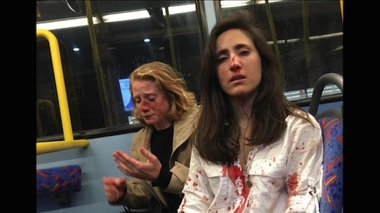 Homophobie : deux lesbiennes agressées pour avoir refusé de s’embrasser en public