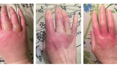 Photo d'illustration