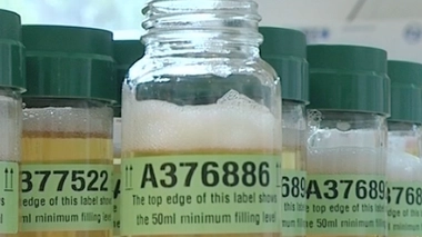 Un financement européen pour un test urinaire de dépistage du cancer de la prostate