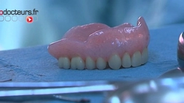 Le patient pensait avoir perdu sa prothèse dentaire