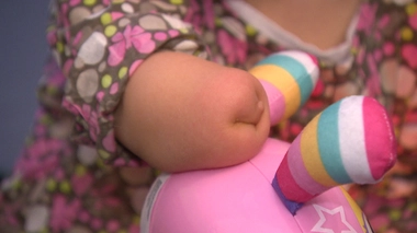 Santé publique France a affirmé n'avoir isolé aucune cause commune pour l’Ain