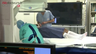 Fibrome utérin : faire le choix de l'embolisation