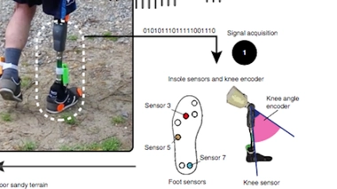 Une prothèse permet de recréer les sensations de la marche