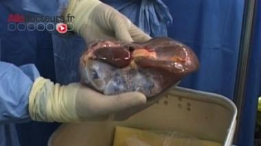 Greffe : une nouvelle technique permet de tripler le temps de conservation des organes