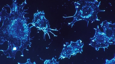 Cellules cancéreuses observées au microscope électronique.