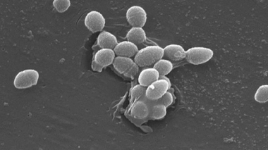 Recrudescence d’une bactérie très résistante aux antibiotiques près de Foix