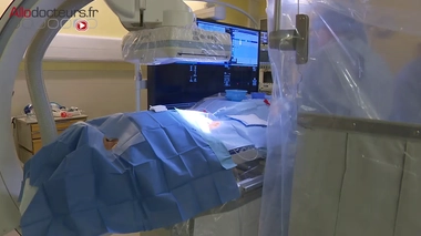 Une intervention pour éliminer les acouphènes pulsatiles