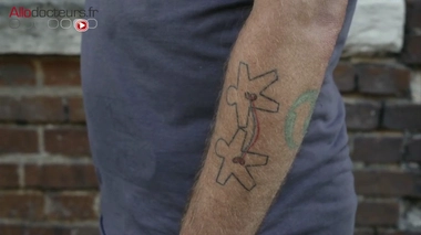 Don de rein à un proche : le don d'une vie meilleure