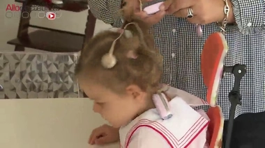 Quelles sont les complications du cytomégalovirus contracté pendant la grossesse ?