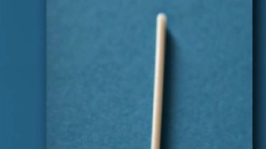 Implant contraceptif : alerte après deux cas de migration dans les poumons