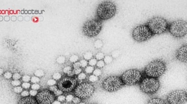 Gastroentérite : le retour en fête