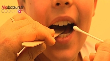 Angine : la mise en place des tests gratuits en pharmacie reportée