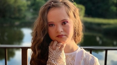 A 15 ans, une ado atteinte de trisomie 21 devient mannequin