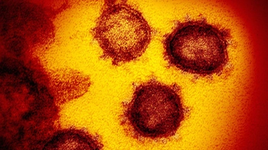 Covid-19 : une étude montre un risque important de phlébite chez les patients intubés